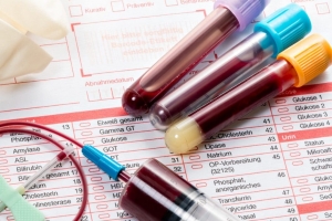Общий клинический анализ крови